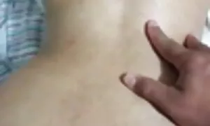 σε πρωκτική πρόπτωση ...